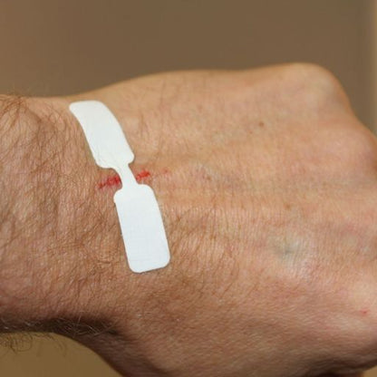 Adhesive Butterfly Wound Closure - 16 Per Single Unit Box